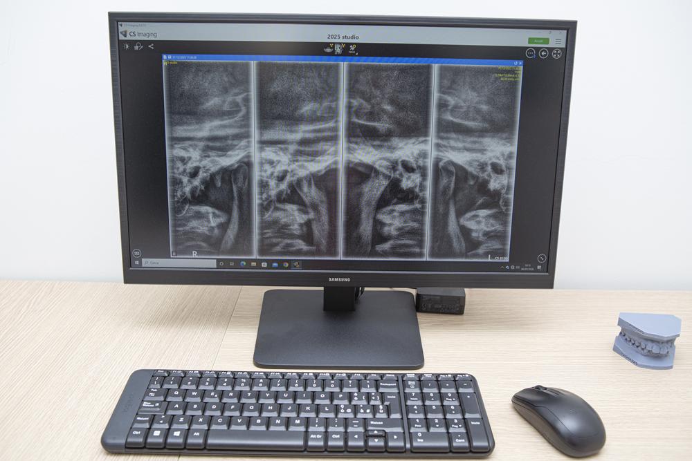 referto radiografie dei denti