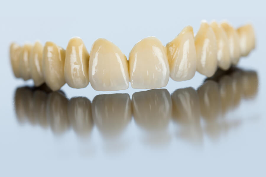 protesi fissa dei denti
