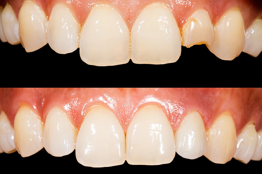 terapia conservativa denti